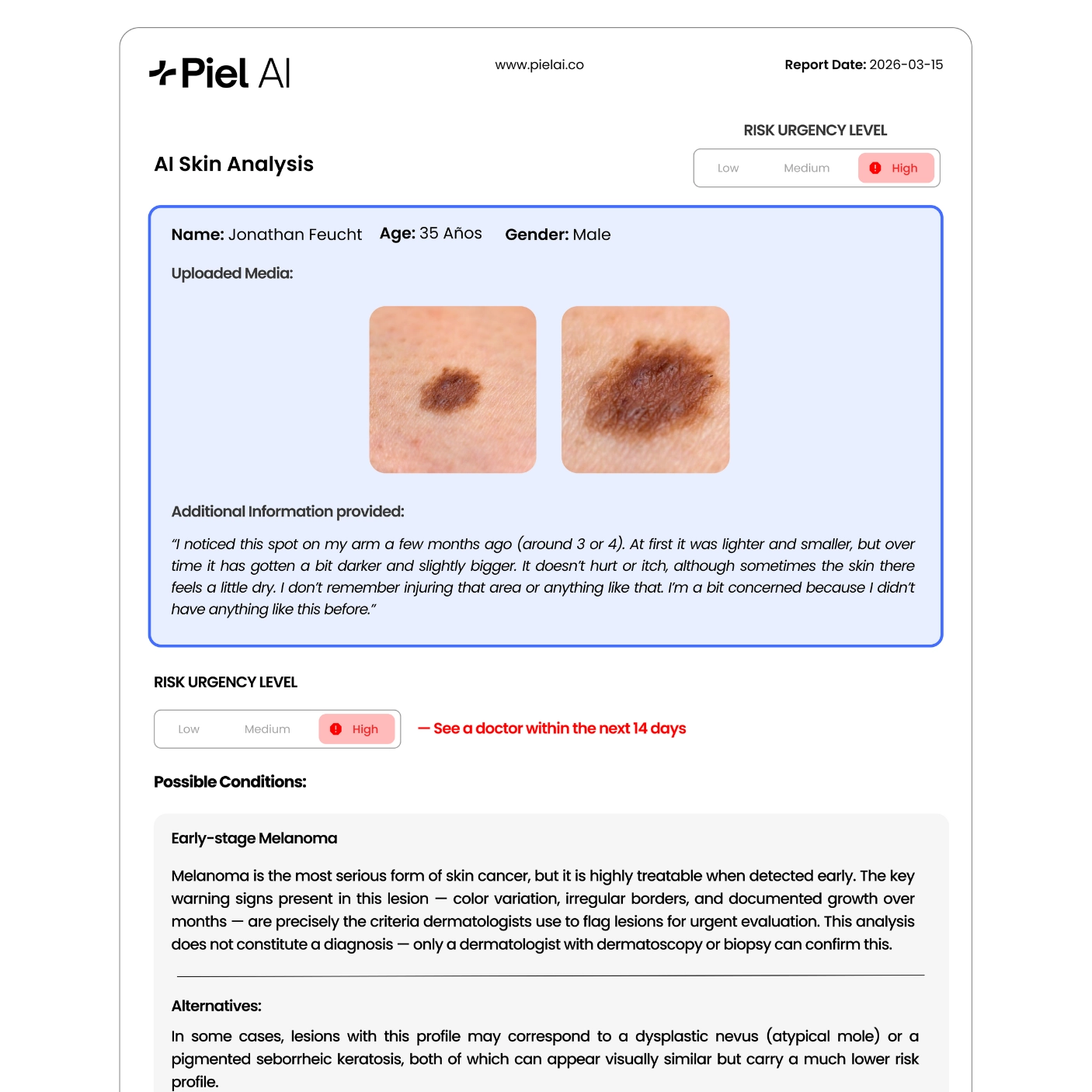 Personalized skin analysis report